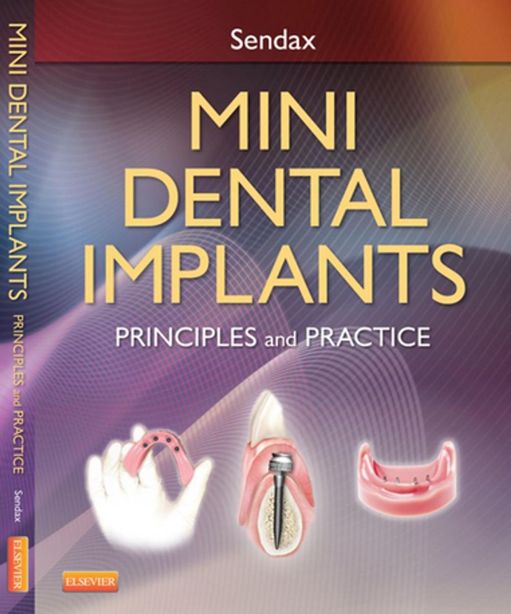 Big bigCover of Mini Dental Implants - E-Book