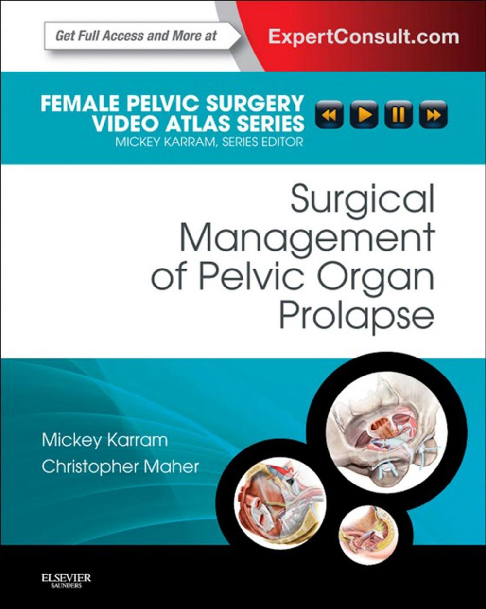 Big bigCover of Surgical Management of Pelvic Organ Prolapse E-Book