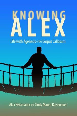 Cover of the book Knowing Alex by Loren Murfield, PHD, Johnny Rodgers