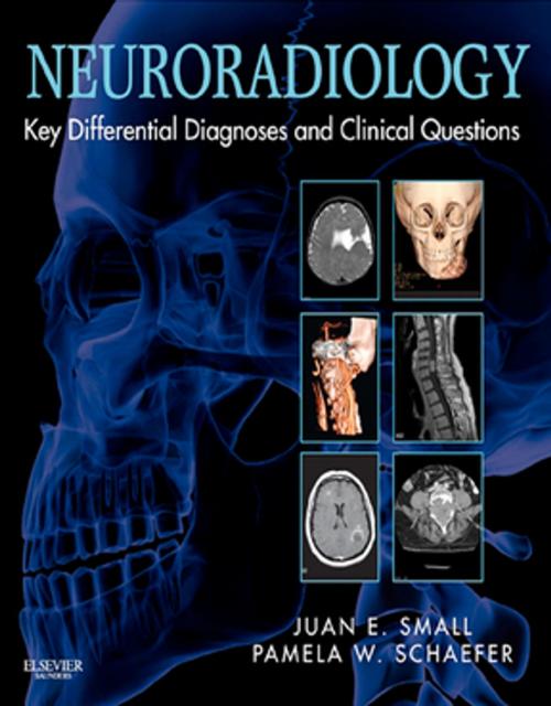 Cover of the book Neuroradiology: Key Differential Diagnoses and Clinical Questions E-Book by Juan E. Small, MD, MSc, Pamela W. Schaefer, MD, Elsevier Health Sciences