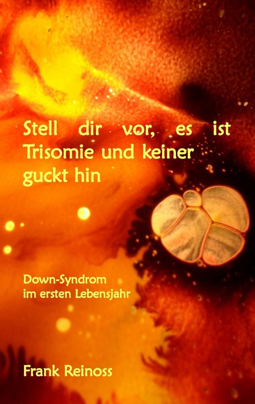 Cover of the book Stell dir vor es ist Trisomie und keiner guckt hin by Frank Reinoss, Books on Demand