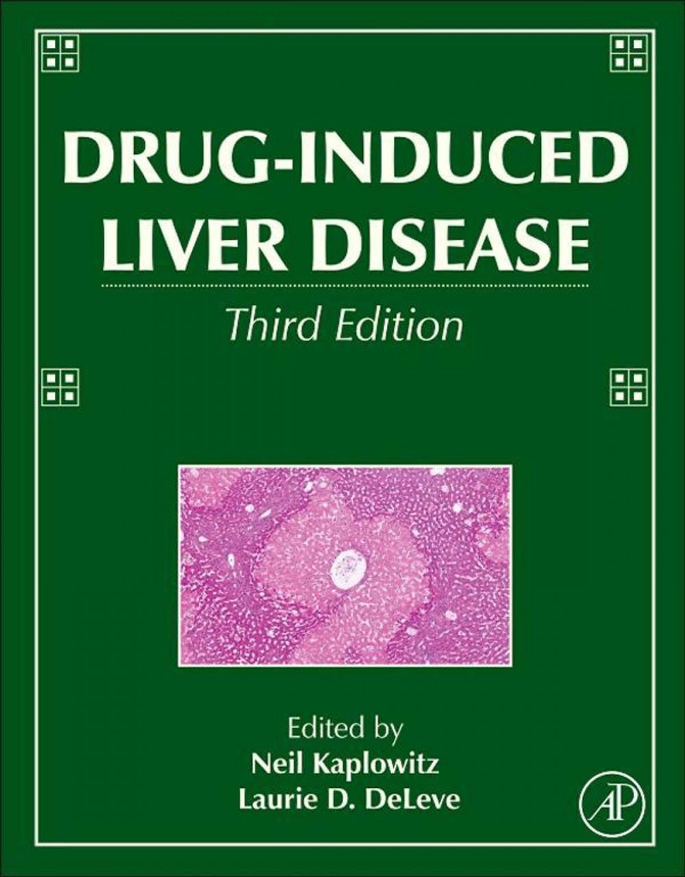 Big bigCover of Drug-Induced Liver Disease