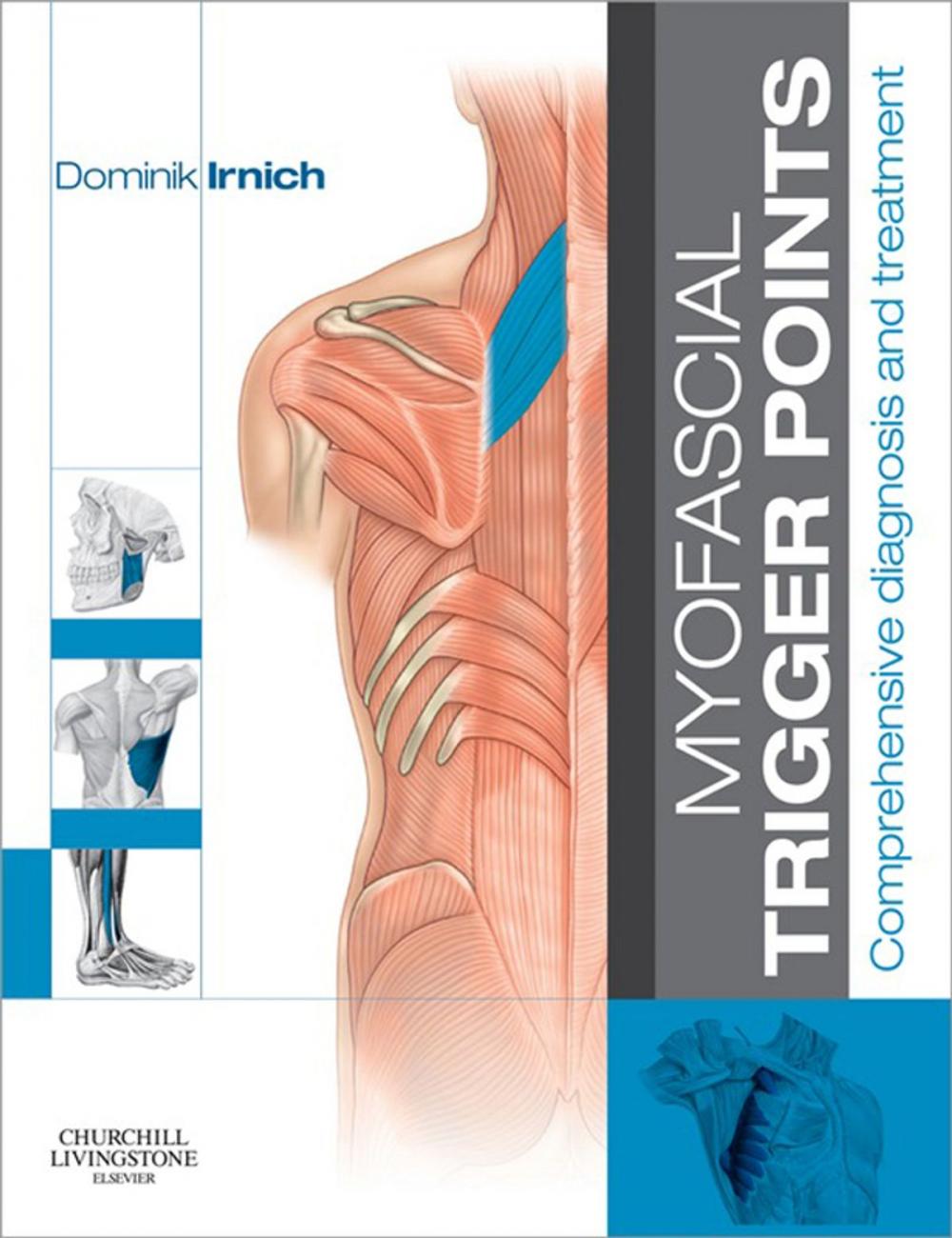 Big bigCover of Myofascial Trigger Points - E-Book