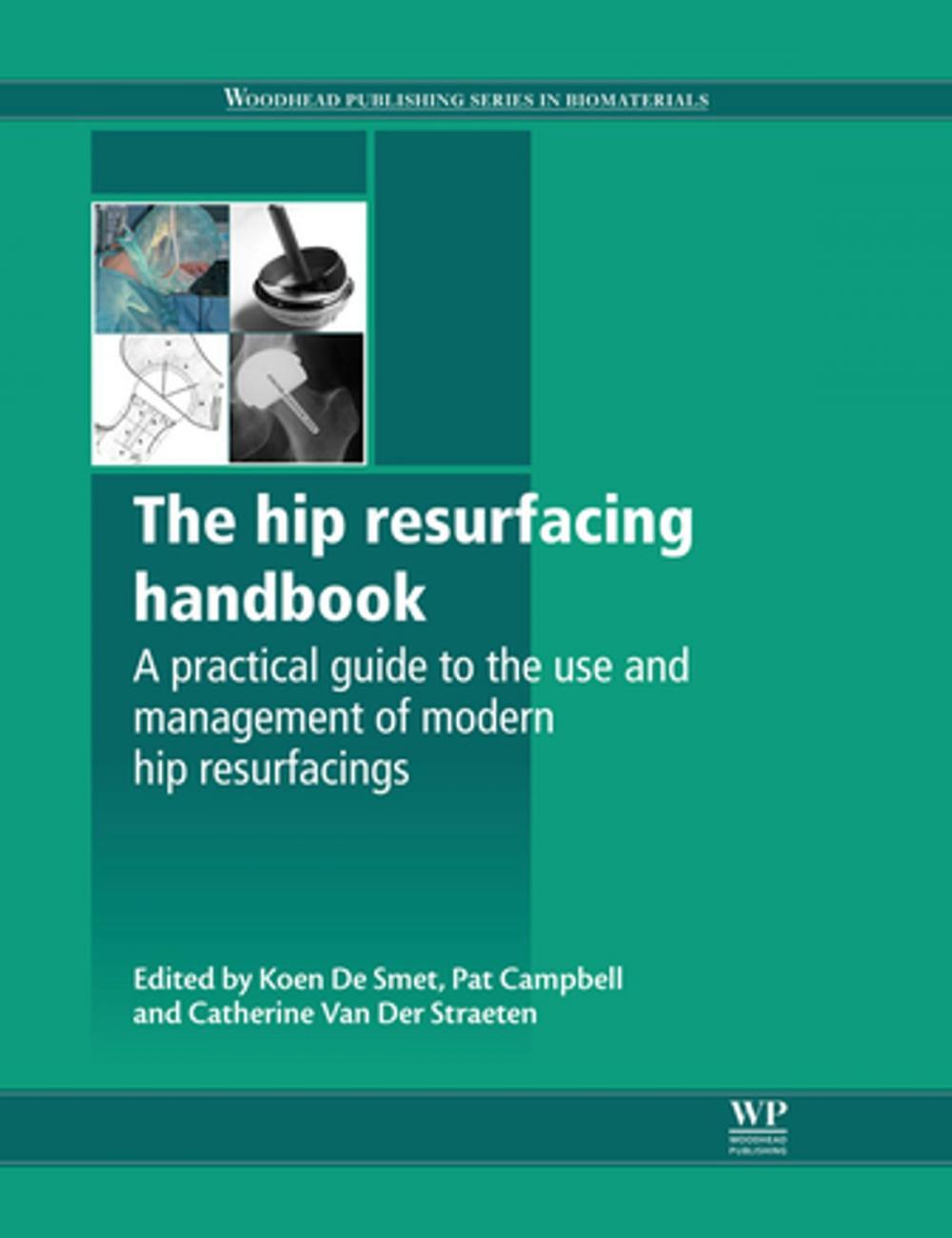 Big bigCover of The Hip Resurfacing Handbook