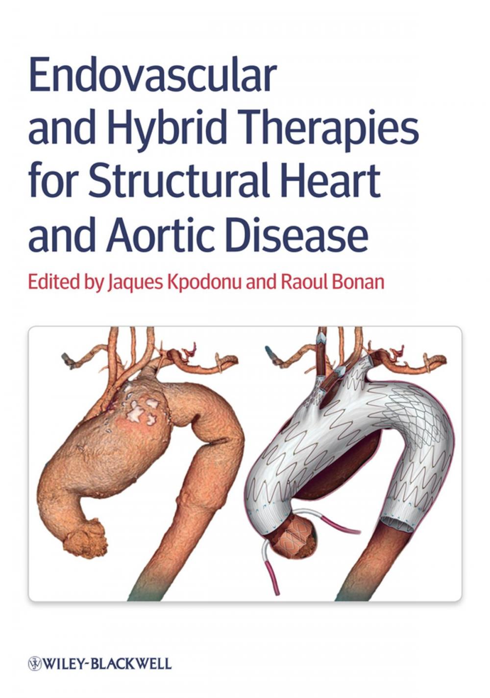 Big bigCover of Endovascular and Hybrid Therapies for Structural Heart and Aortic Disease