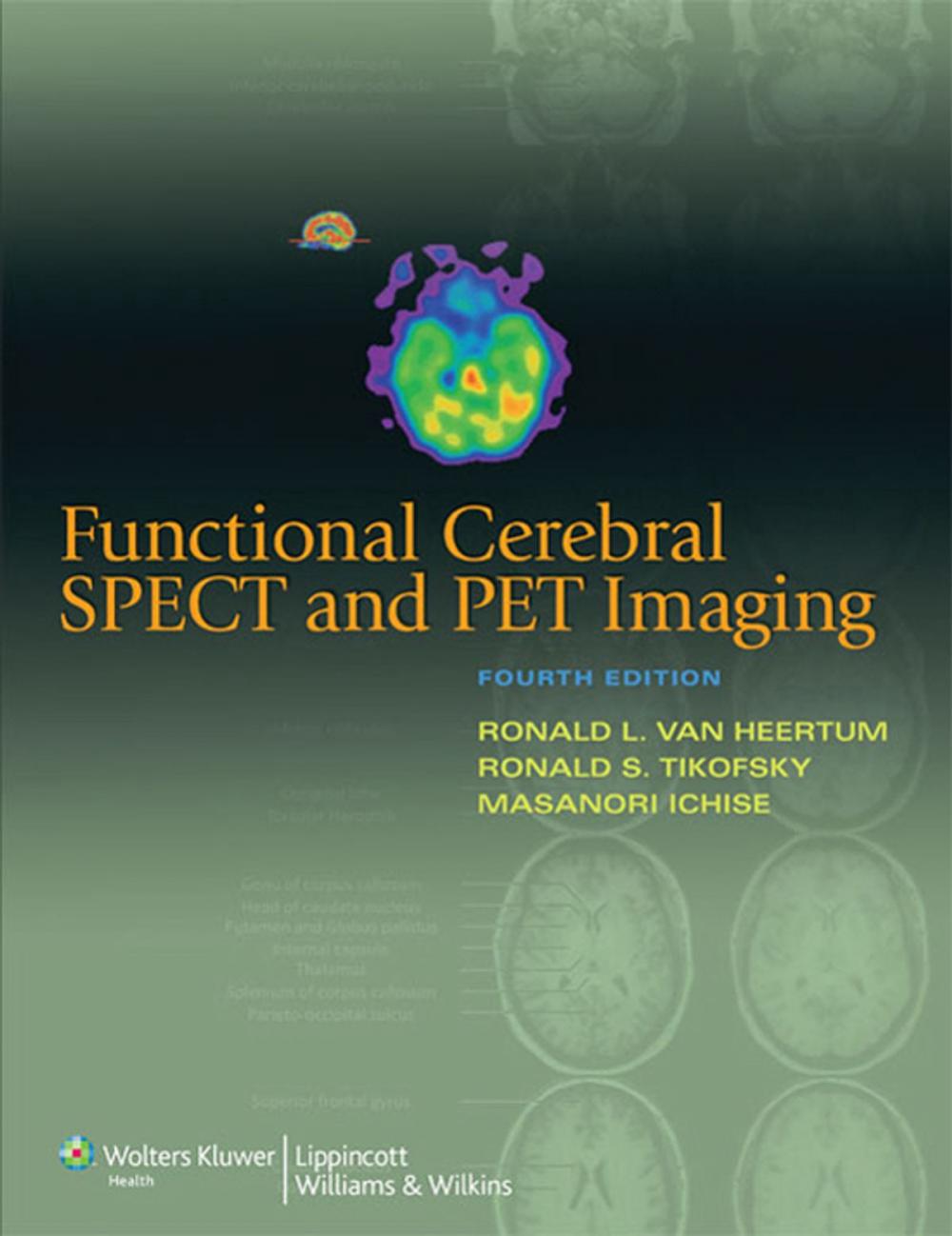 Big bigCover of Functional Cerebral SPECT and PET Imaging