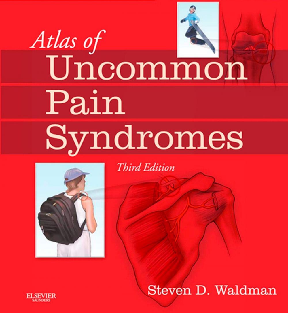 Big bigCover of Atlas of Uncommon Pain Syndromes