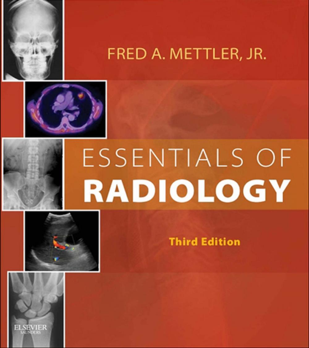 Big bigCover of Essentials of Radiology E-Book