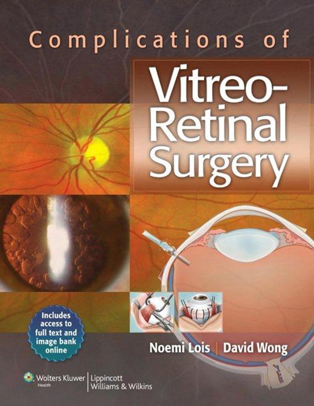 Big bigCover of Complications of Vitreo-Retinal Surgery