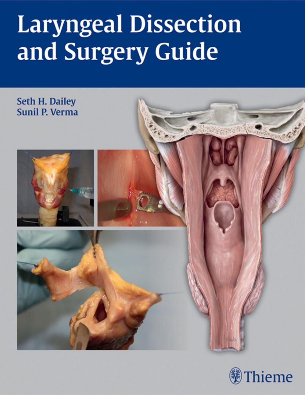 Big bigCover of Laryngeal Dissection and Surgery Guide