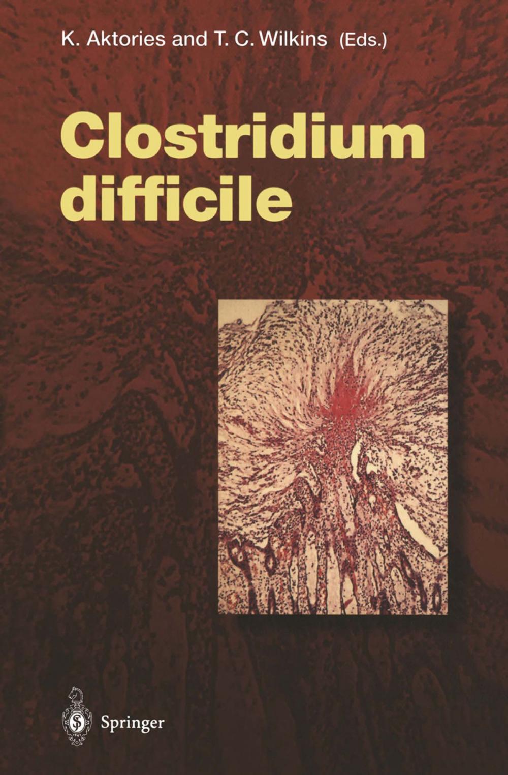 Big bigCover of Clostridium difficile