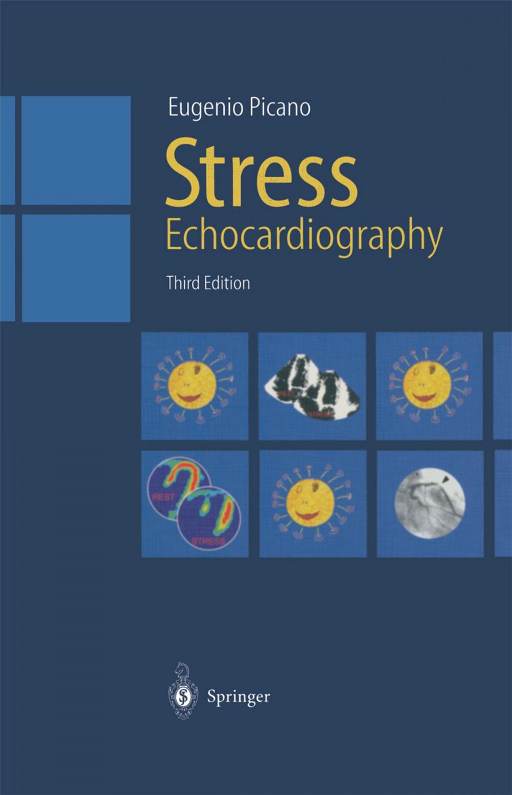 Big bigCover of Stress Echocardiography