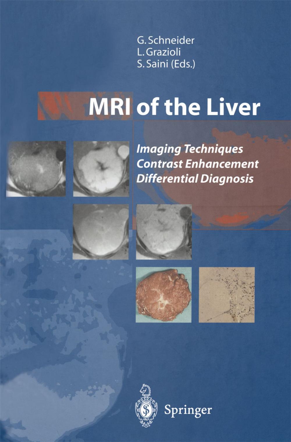 Big bigCover of MRI of the Liver