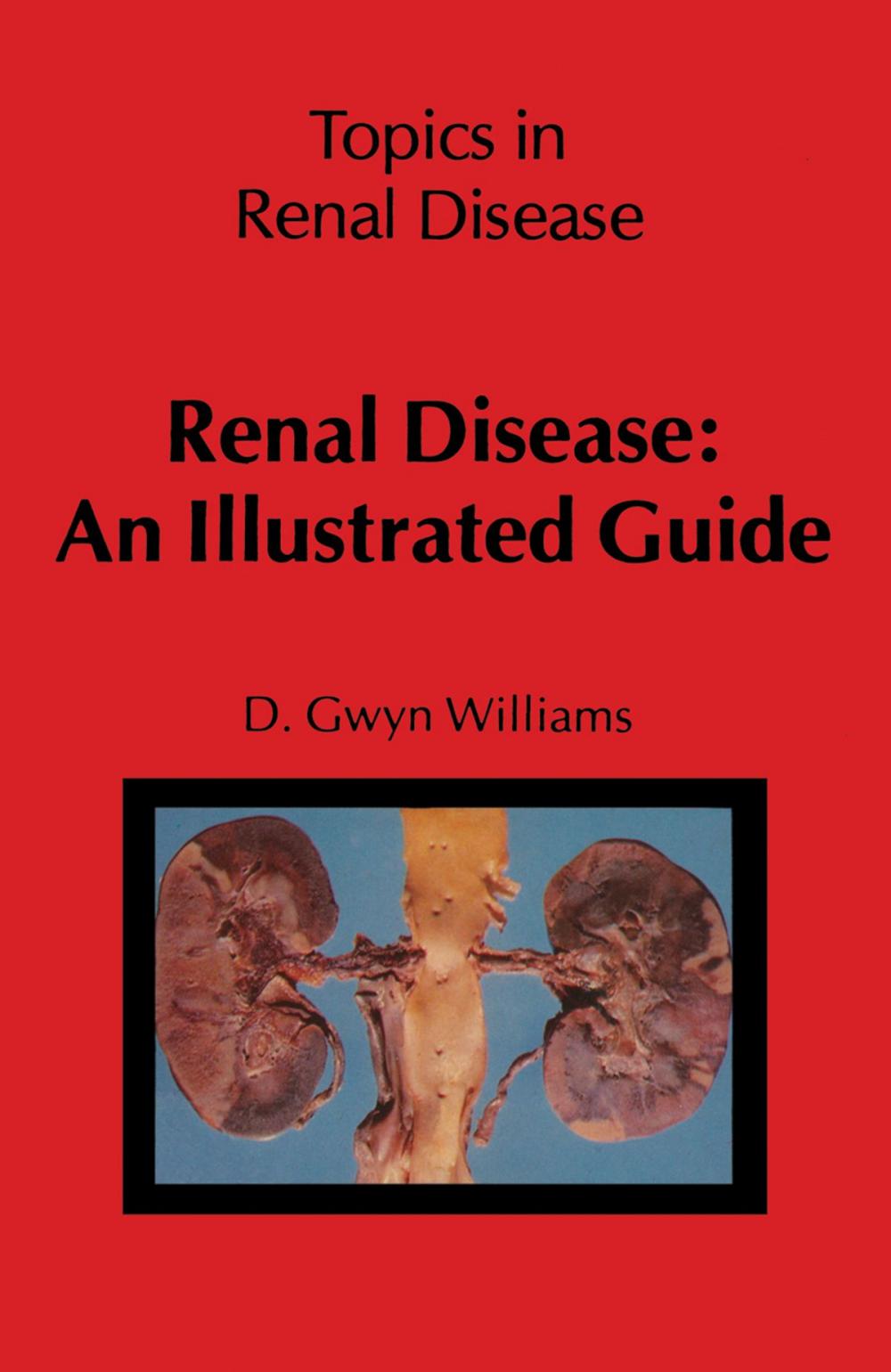 Big bigCover of Renal Disease: An Illustrated Guide