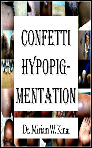 Cover of Confetti Hypopigmentation