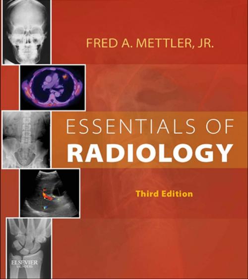 Cover of the book Essentials of Radiology E-Book by Fred A. Mettler Jr., MD, MPH, Elsevier Health Sciences