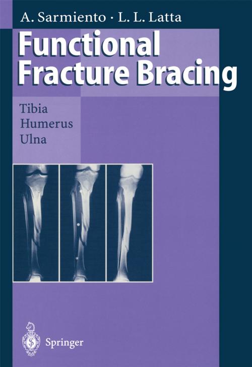 Cover of the book Functional Fracture Bracing by Augusto Sarmiento, Loren L. Latta, Springer Berlin Heidelberg