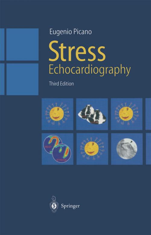 Cover of the book Stress Echocardiography by Eugenio Picano, Springer Berlin Heidelberg