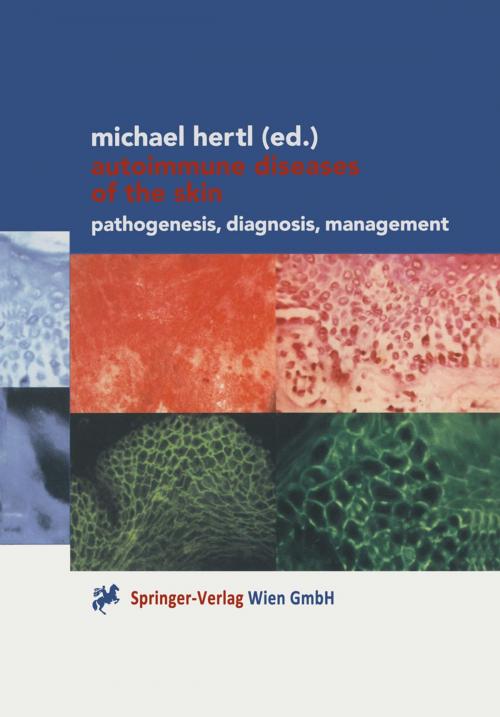 Cover of the book Autoimmune Diseases of the Skin by , Springer Vienna