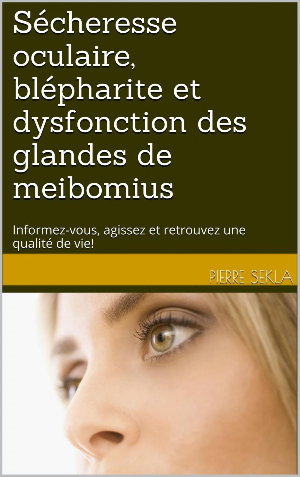 Big bigCover of Sécheresse oculaire, blépharite et dysfonction des glandes de meibomius