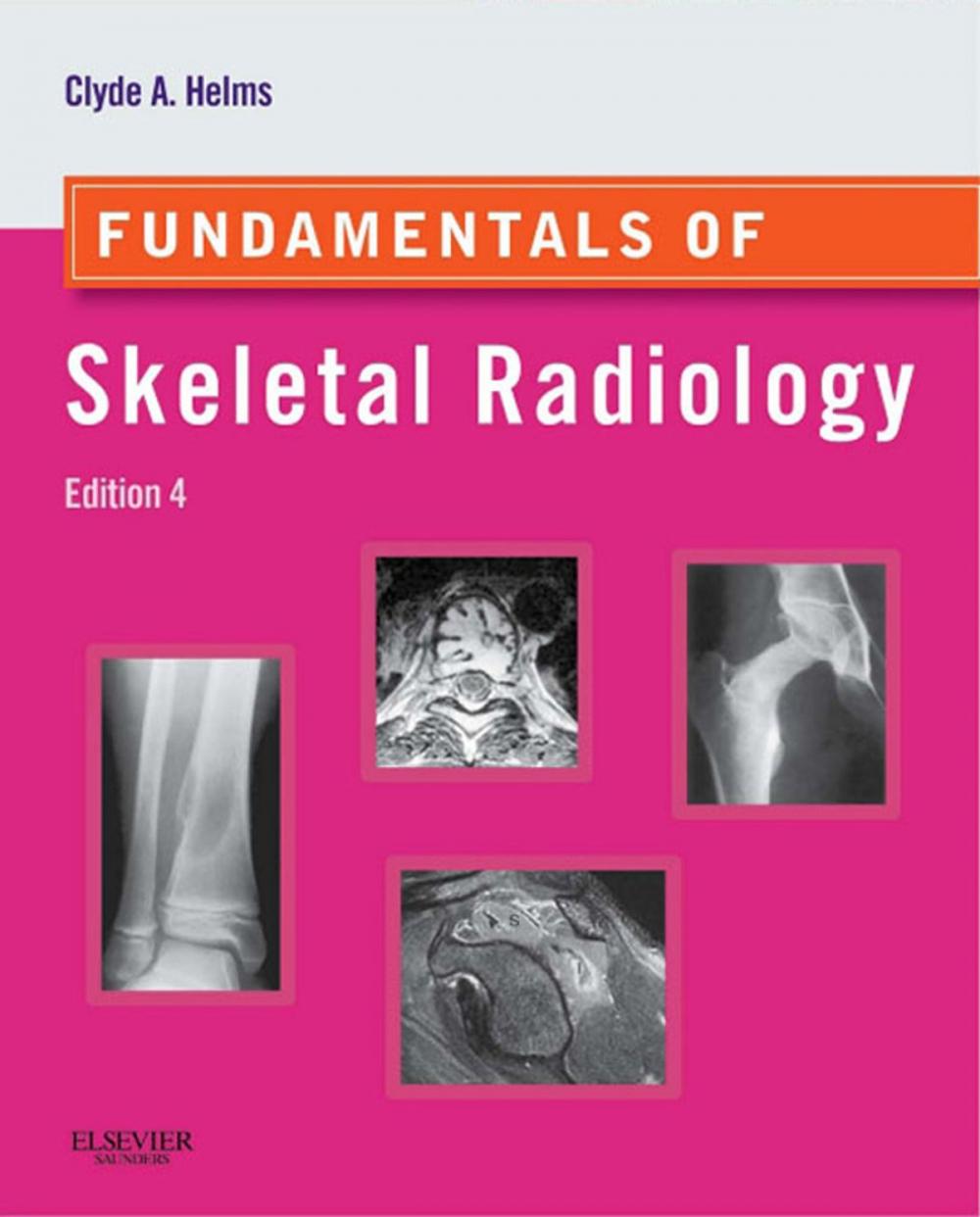 Big bigCover of Fundamentals of Skeletal Radiology E-Book