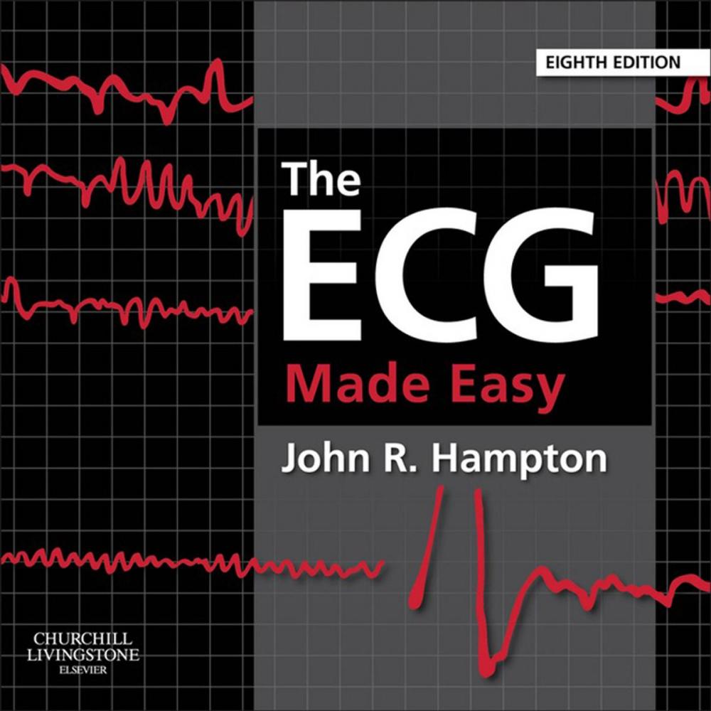 Big bigCover of The ECG Made Easy