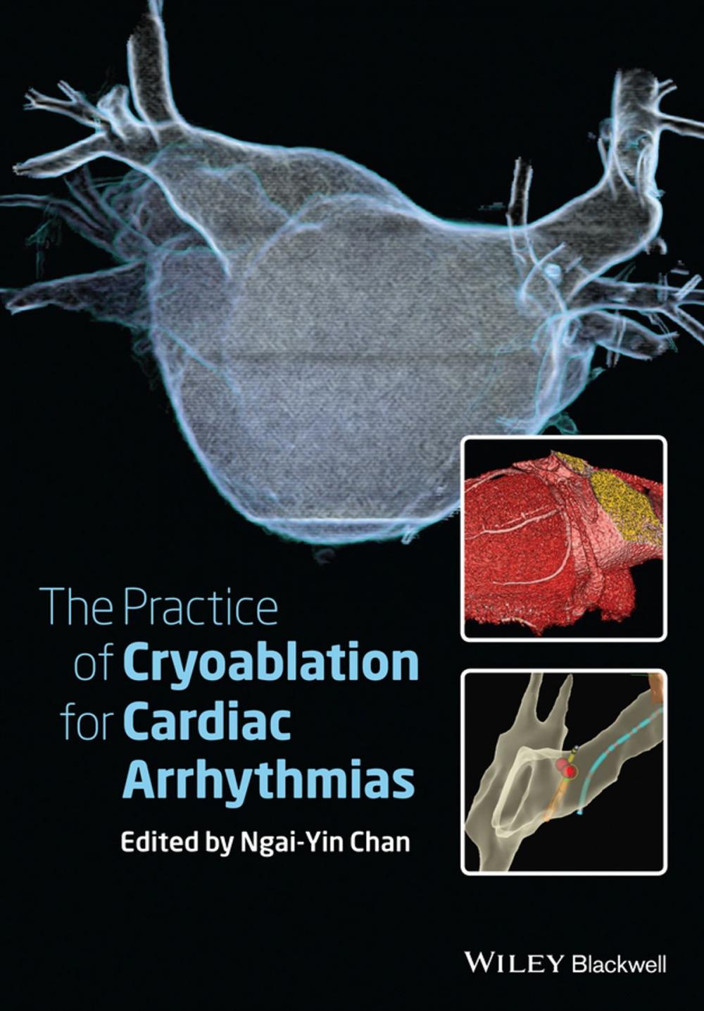 Big bigCover of The Practice of Catheter Cryoablation for Cardiac Arrhythmias, Enhanced Edition