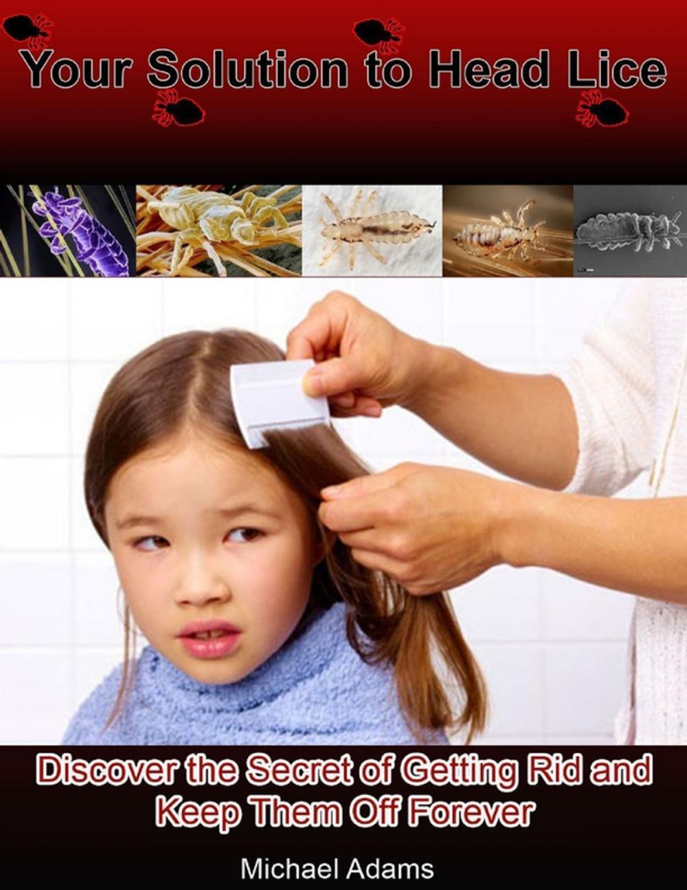 Big bigCover of Your Solution to Head Lice: Discover the Secret of Getting Rid and Keep Them Off Forever