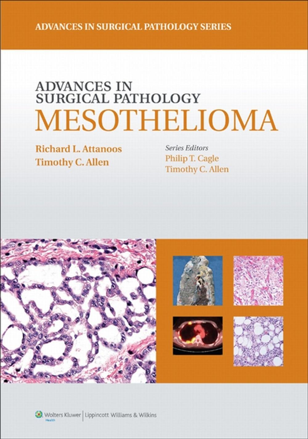 Big bigCover of Advances in Surgical Pathology: Mesothelioma