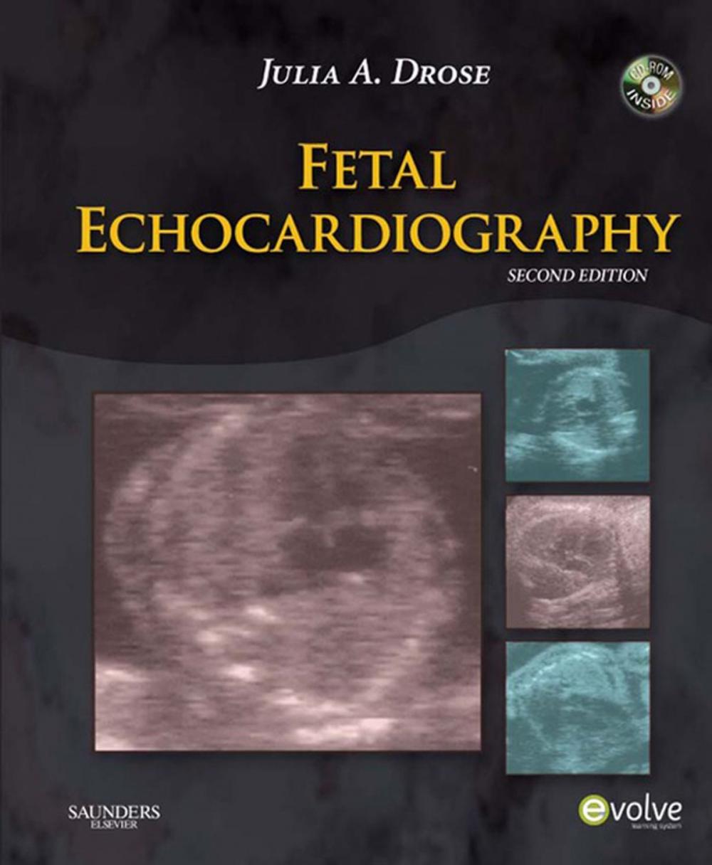 Big bigCover of Fetal Echocardiography - E-Book