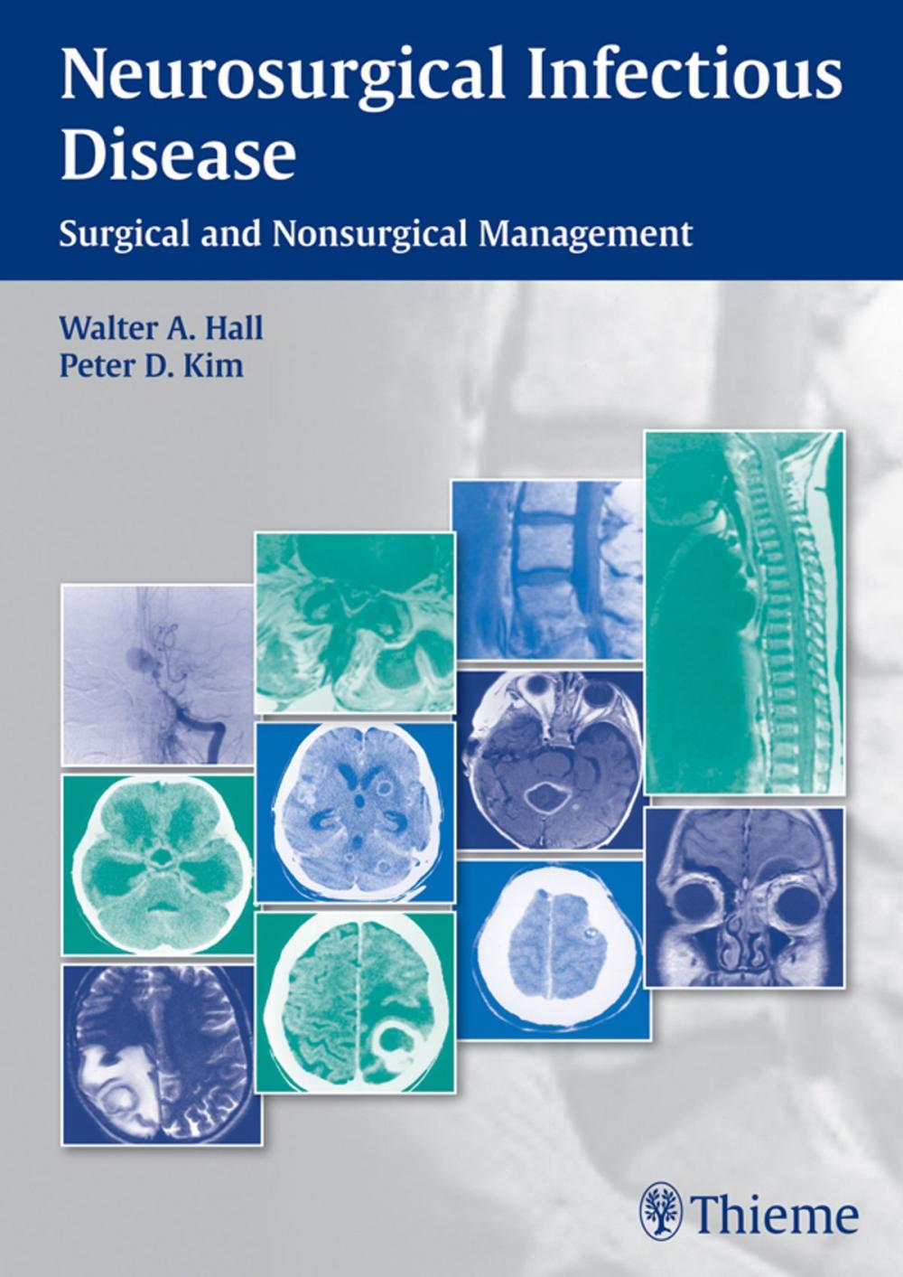 Big bigCover of Neurosurgical Infectious Disease