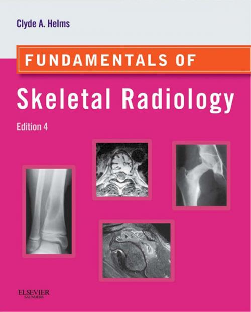 Cover of the book Fundamentals of Skeletal Radiology E-Book by Clyde A. Helms, MD, Elsevier Health Sciences