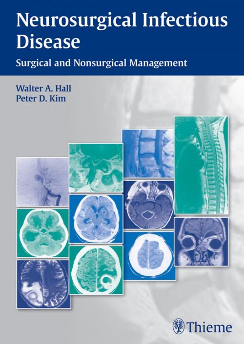 Cover of the book Neurosurgical Infectious Disease by , Thieme