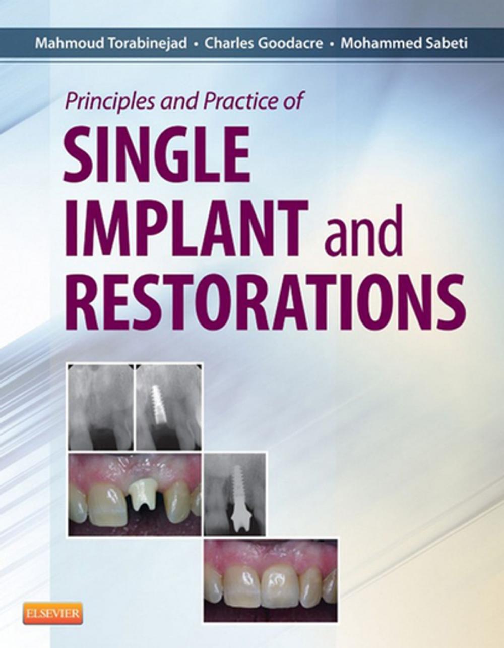 Big bigCover of Principles and Practice of Single Implant and Restoration - E-Book