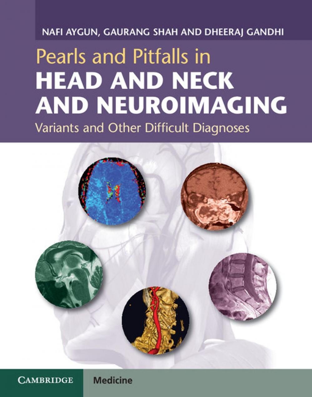 Big bigCover of Pearls and Pitfalls in Head and Neck and Neuroimaging