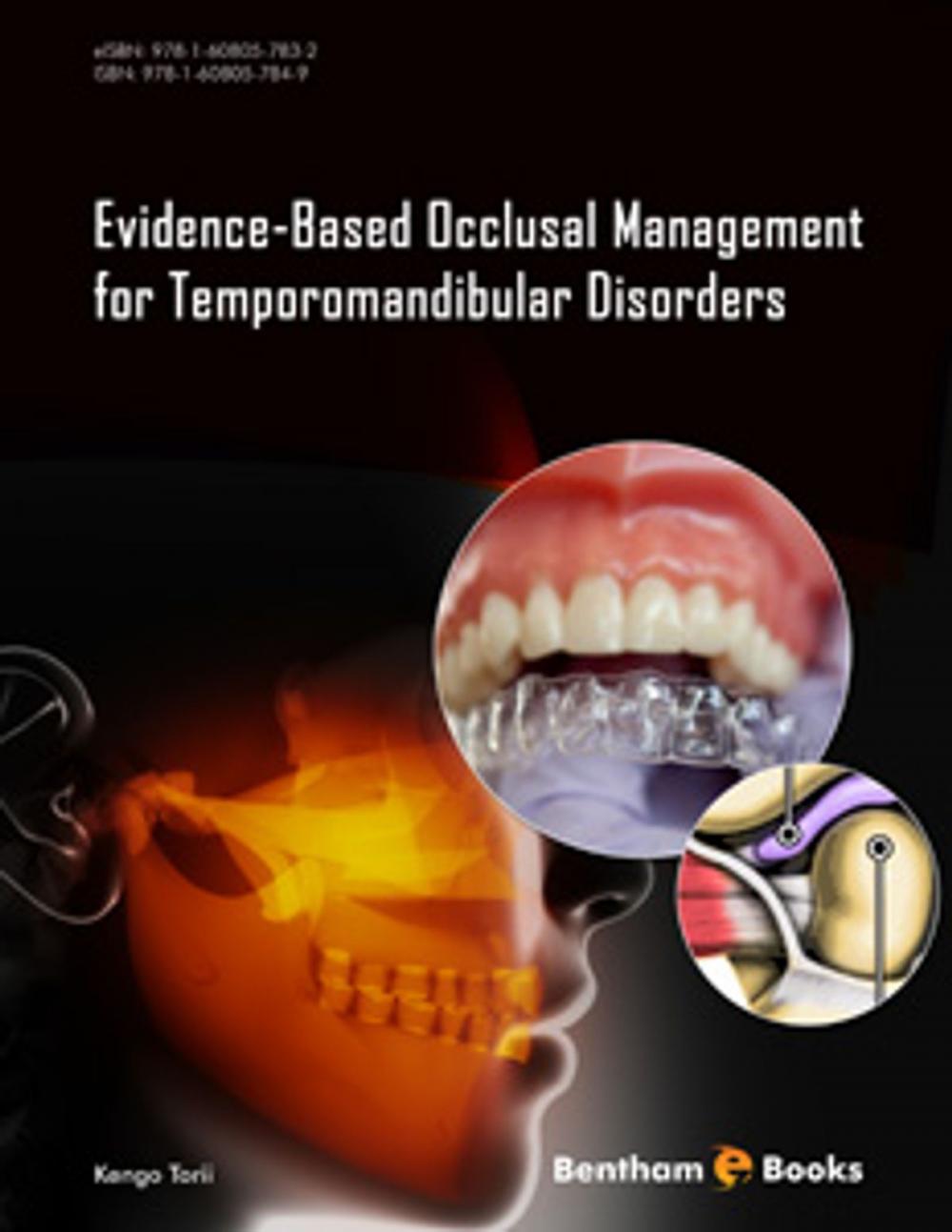 Big bigCover of Evidence-Based Occlusal Management for Temporomandibular Disorders