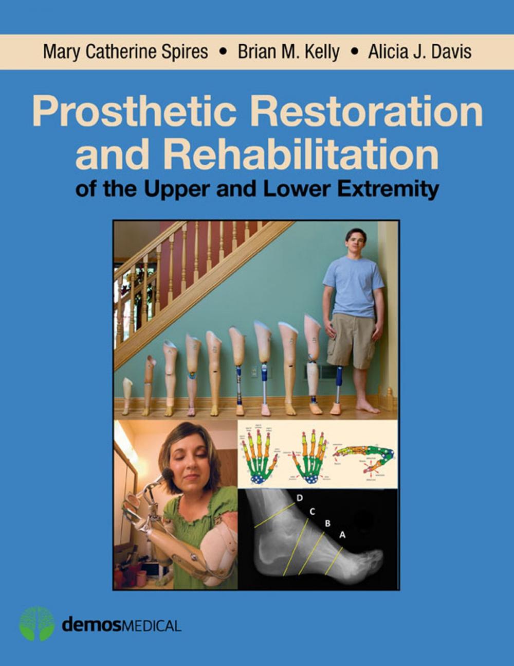 Big bigCover of Prosthetic Restoration and Rehabilitation of the Upper and Lower Extremity