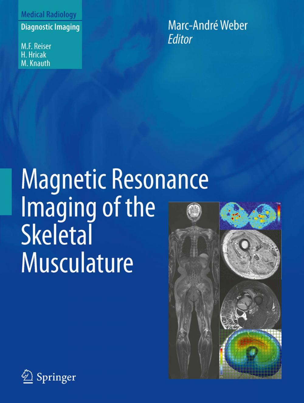 Big bigCover of Magnetic Resonance Imaging of the Skeletal Musculature