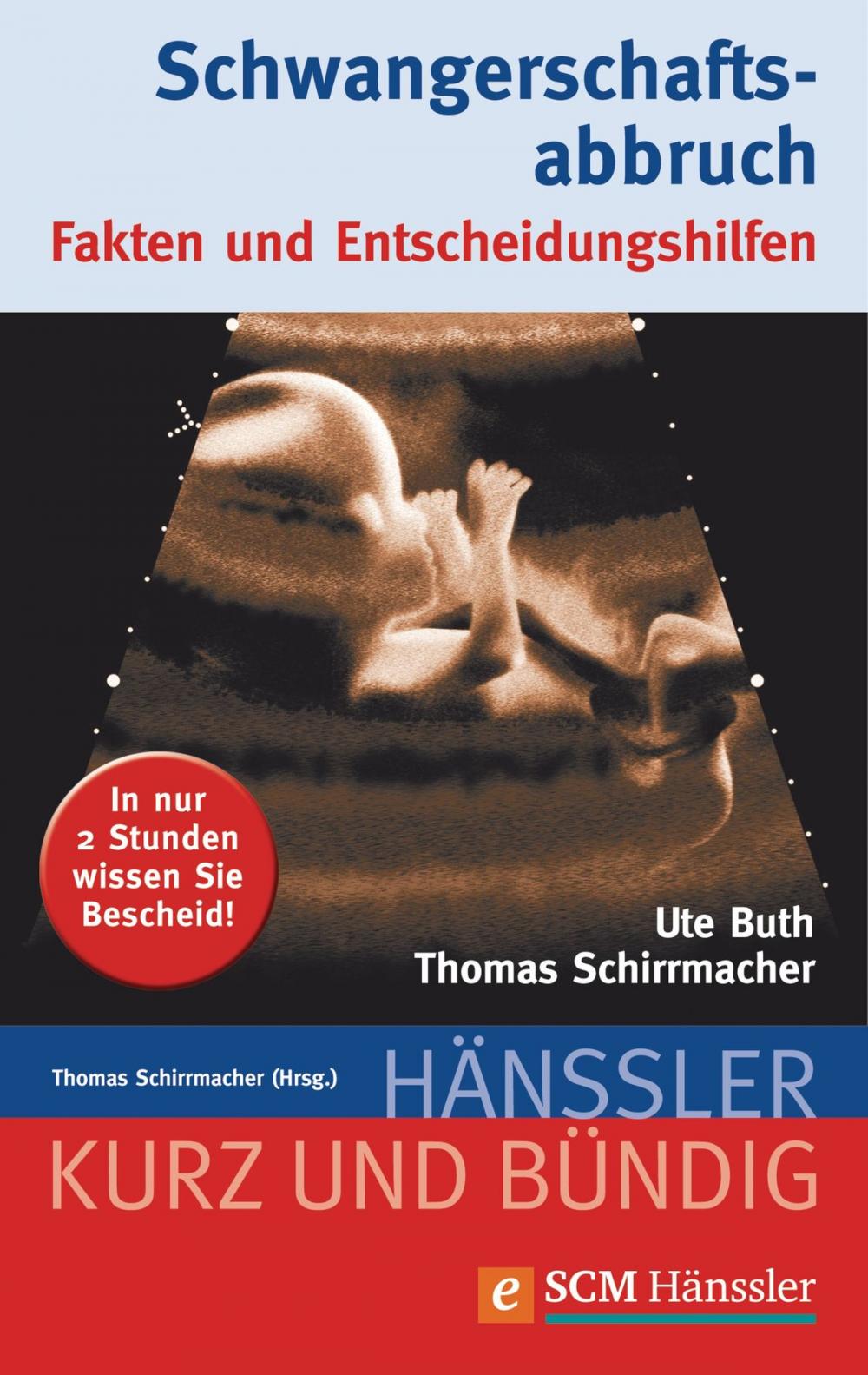 Big bigCover of Schwangerschaftsabbruch