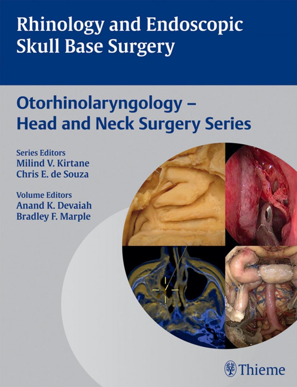 Big bigCover of Rhinology and Endoscopic Skull Base Surgery