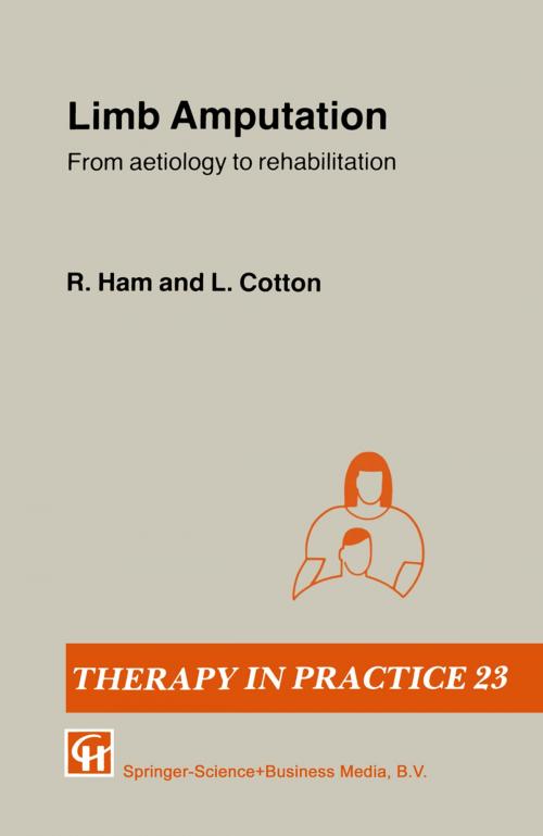 Cover of the book Limb Amputation by R. Ham, L. T. Cotton, Springer US