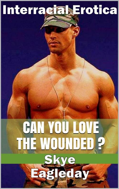 Cover of the book Can You Love The Wounded? (Interracial Erotica) by Skye Eagleday, Skye Eagleday