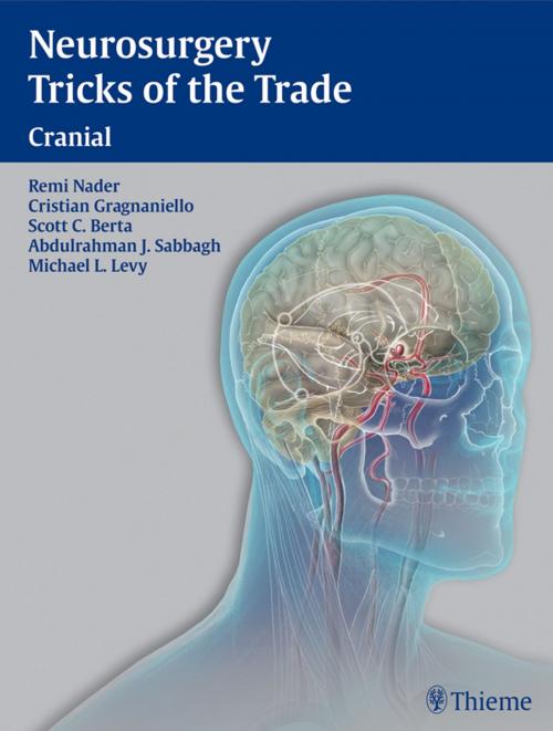 Cover of the book Neurosurgery Tricks of the Trade - Cranial by , Thieme