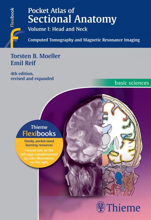 Cover of the book Pocket Atlas of Sectional Anatomy, Volume I: Head and Neck by Torsten Bert Moeller, Emil Reif, Thieme