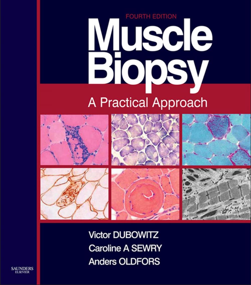 Big bigCover of Muscle Biopsy E-Book