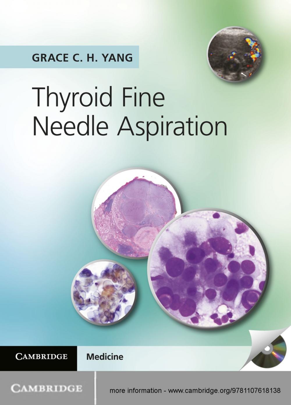 Big bigCover of Thyroid Fine Needle Aspiration