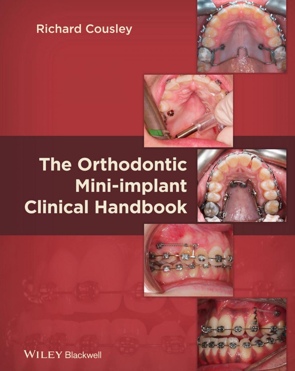 Big bigCover of The Orthodontic Mini-implant Clinical Handbook