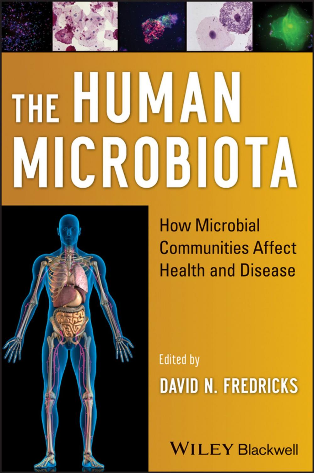 Big bigCover of The Human Microbiota