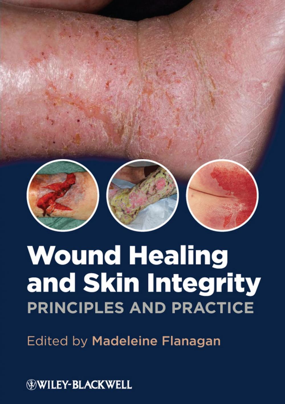 Big bigCover of Wound Healing and Skin Integrity