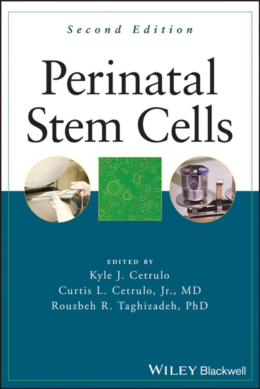 Big bigCover of Perinatal Stem Cells